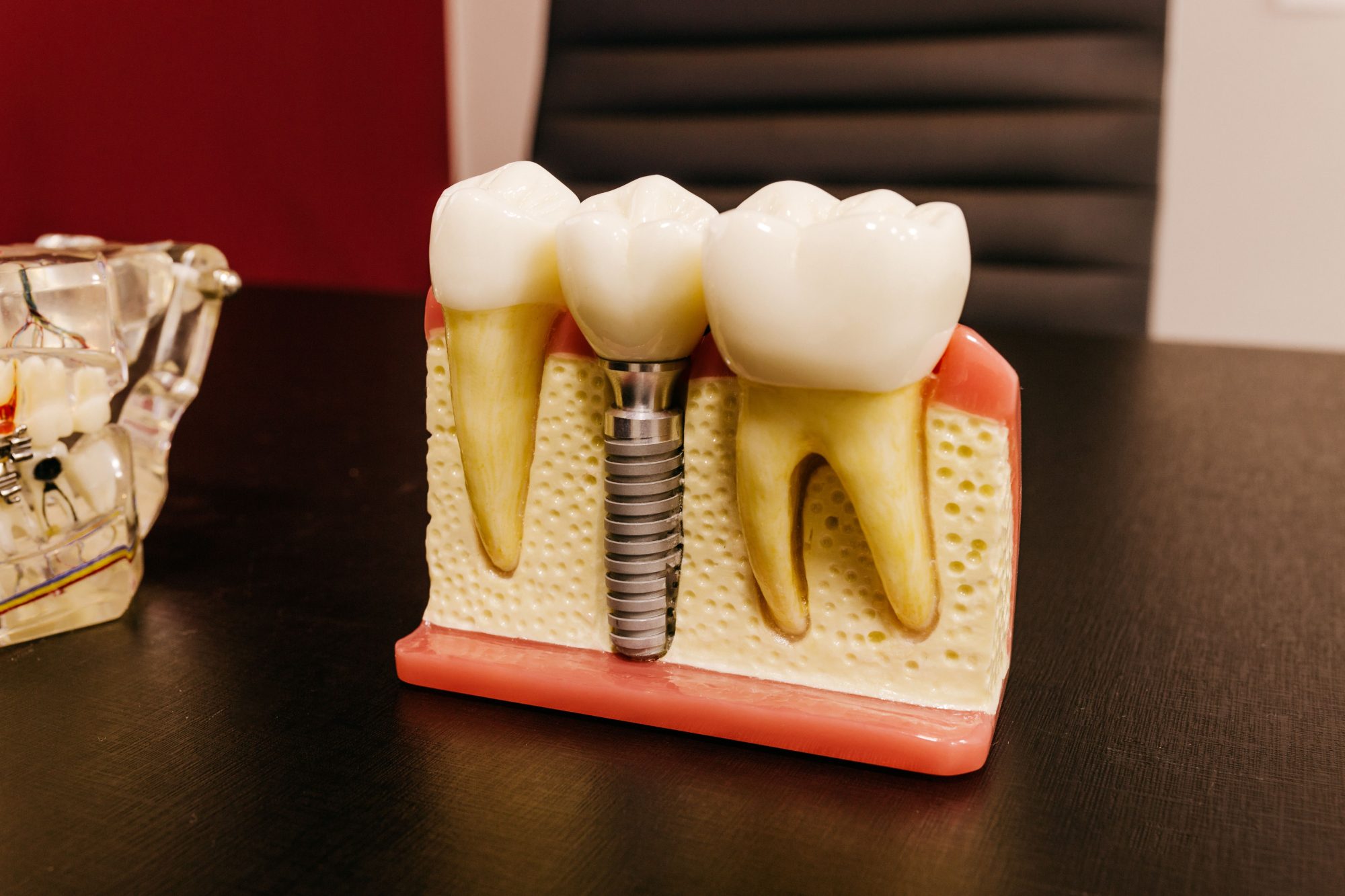 Smilecare Dental course