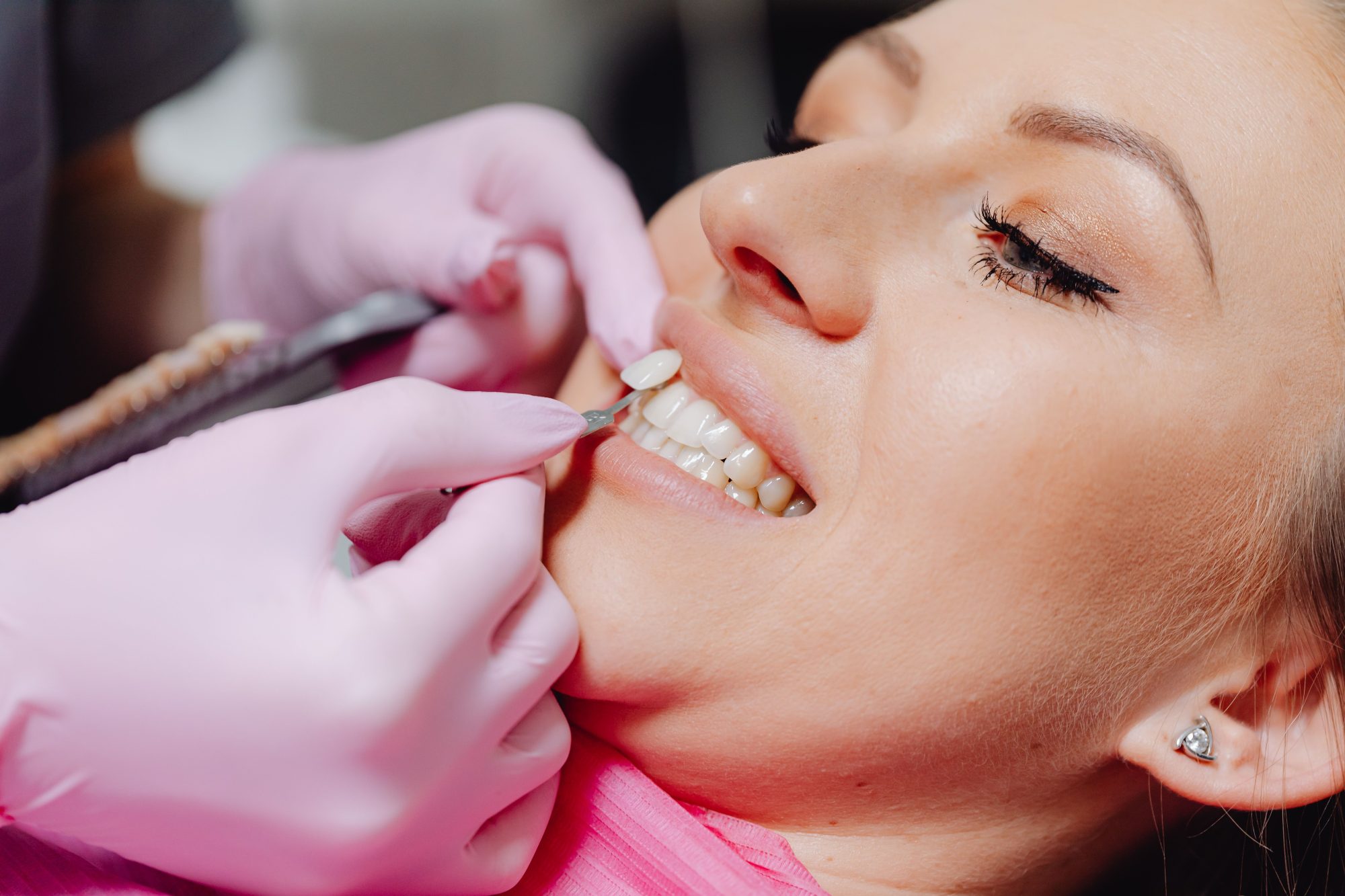 Smilecare Dental hero