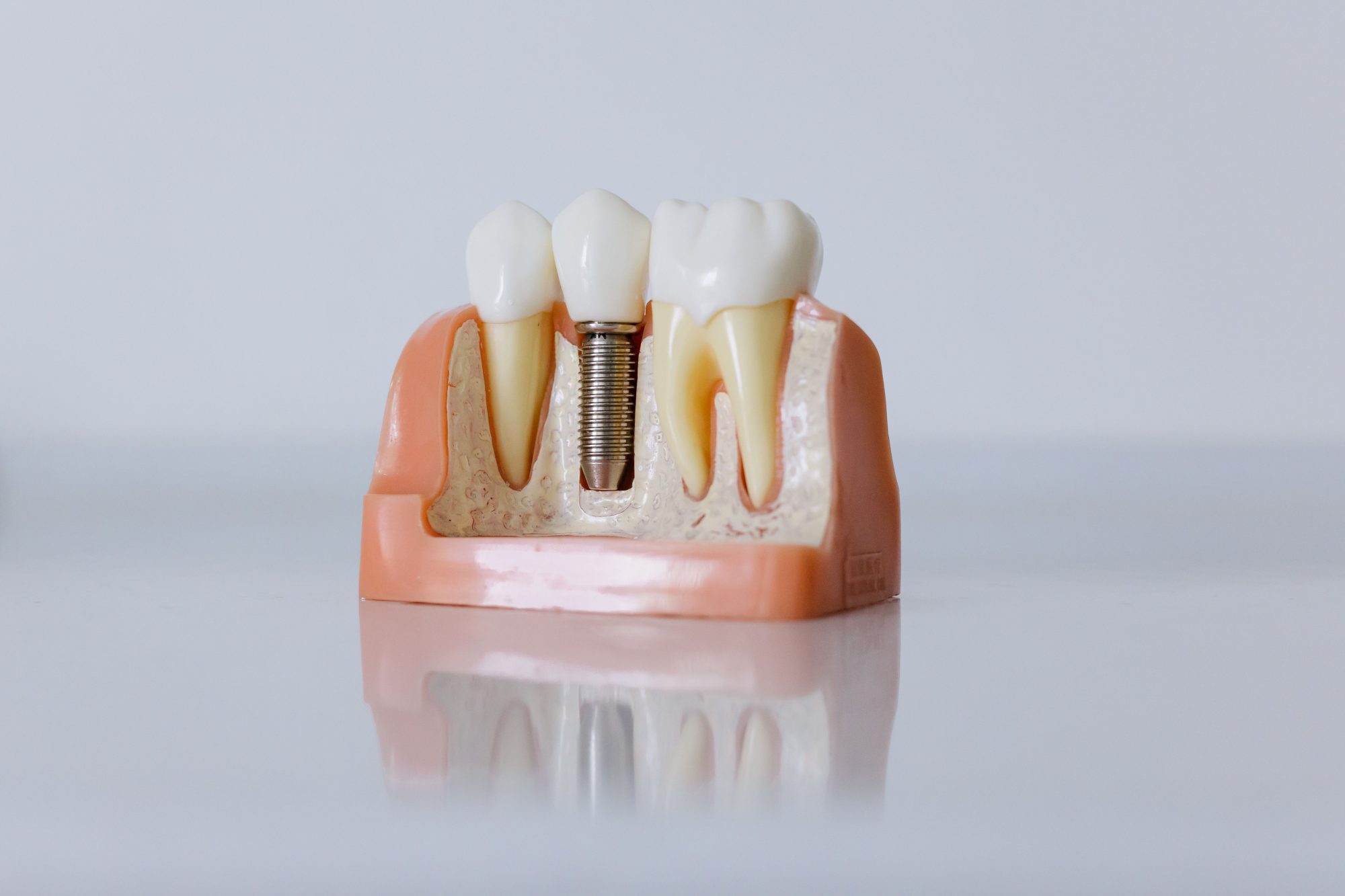 Smilecare Dental hero